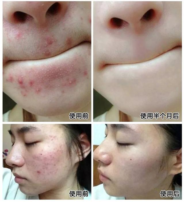 羊奶皂的使用方法，手工羊奶皂的使用方法（修护肌肤建立屏障）