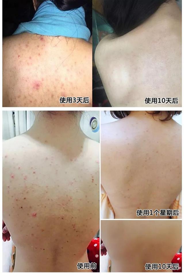 羊奶皂的使用方法，手工羊奶皂的使用方法（修护肌肤建立屏障）