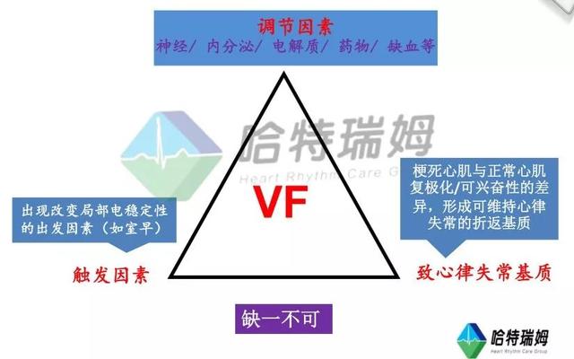 室颤的典型心电图表现，警惕室颤突然来袭