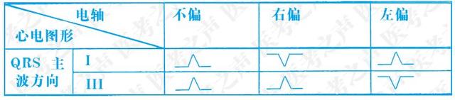 通俗易懂的心电图基础介绍，零基础都秒懂：学习心电图