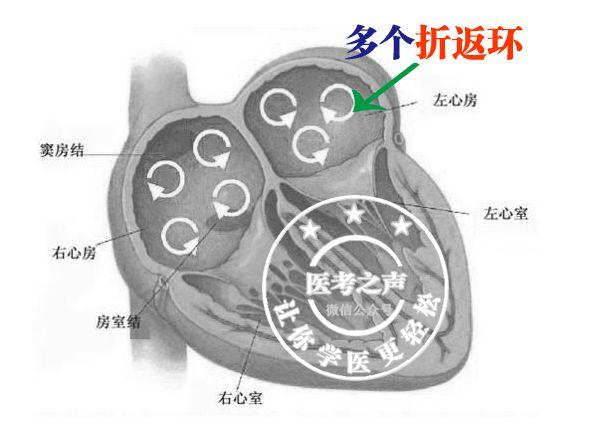 通俗易懂的心电图基础介绍，零基础都秒懂：学习心电图