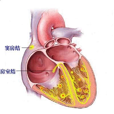 通俗易懂的心电图基础介绍，零基础都秒懂：学习心电图