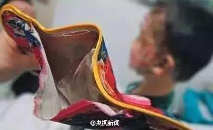 如何挑选热水袋，热水袋的气怎么排出（如何正确挑选电热水袋）