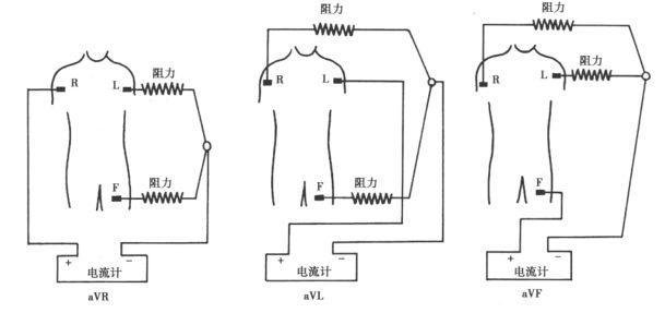心電圖所有導聯的放置位置,肢體導聯電極錯接的心電圖分析及鑑別
