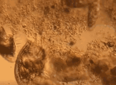 穿无痕内裤好吗，穿无痕内裤好吗男生（裆部总是潮呼呼，又痒又臭）