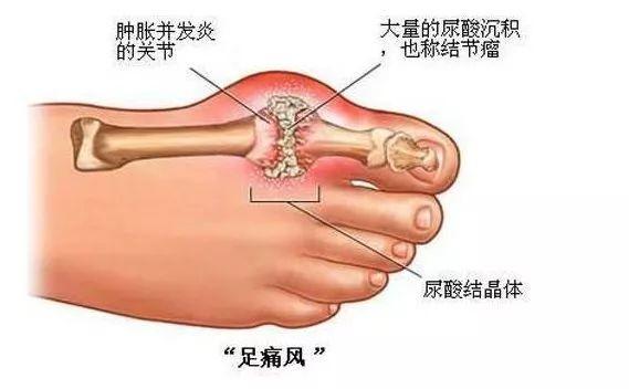 血压与年龄标准对照表，年龄血压对照表（各年龄段血压、血糖、血脂、尿酸对照表看这里）