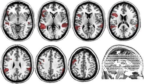 hbf小组，求分享黑蝙蝠hbf合集!（被无数人接受的智商测试）