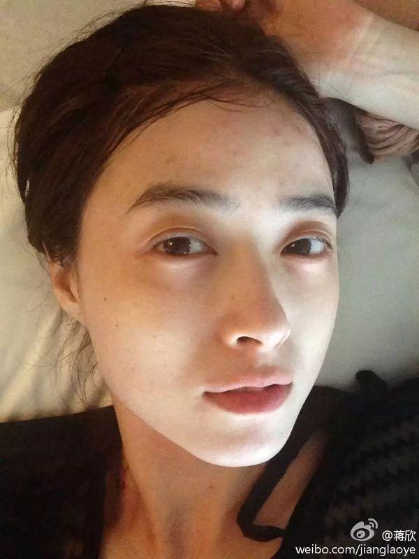 蔡依林锦荣分手,蔡依林锦荣分手后(女明星到底日常是如何抗痘的)