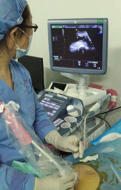 羊水穿刺检查，羊水穿刺检查和无创DNA到底做哪个（7张图向你“播报”全过程）