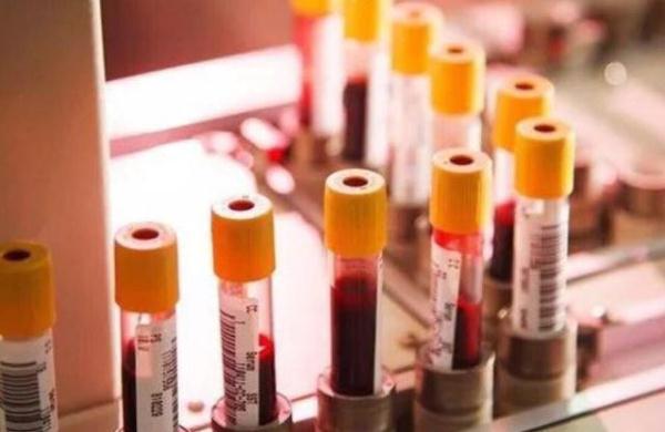 羊水穿刺检查，羊水穿刺检查和无创DNA到底做哪个（7张图向你“播报”全过程）