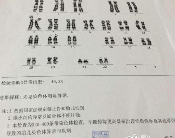 羊水穿刺检查，羊水穿刺检查和无创DNA到底做哪个（7张图向你“播报”全过程）