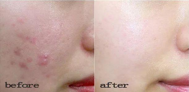 背薄一寸下一句是什么，背薄一寸下一句话怎么说（千万别做“背厚”的人）