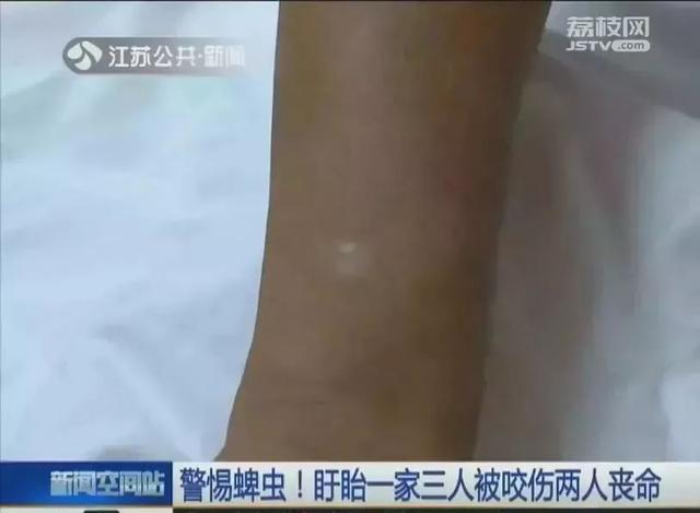 身上长黑点是怎么回事，身上长黑色斑点是什么原因（身上冒出这种“小黑点”别乱拔）