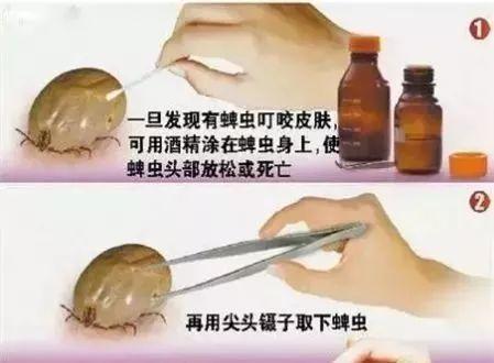 身上长黑点是怎么回事，身上长黑色斑点是什么原因（身上冒出这种“小黑点”别乱拔）