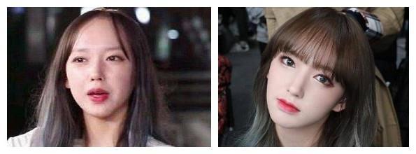 如何降低发际线，如何自然降低发际线（让你改头换面）