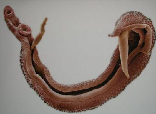 了解血吸虫,让你不再"谈虫色变"!