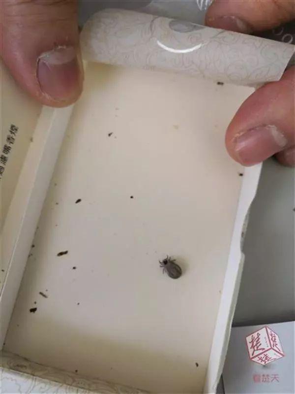 身上长黑点是怎么回事，身上长黑色斑点是什么原因（身上冒出这种“小黑点”别乱拔）