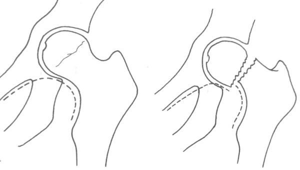 如何踢出s型弧线球，怎样踢出s型球（大诊治误区盘点）