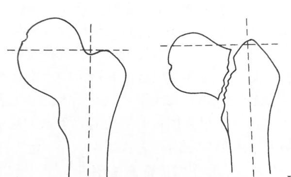 如何踢出s型弧线球，怎样踢出s型球（大诊治误区盘点）