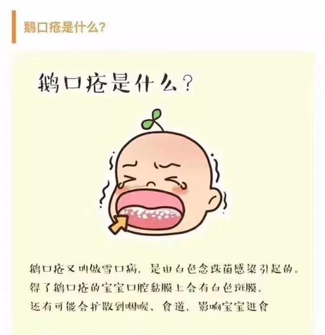 鹅口疮是什么，鹅口疮反反复复怎么办（一图看懂鹅口疮）