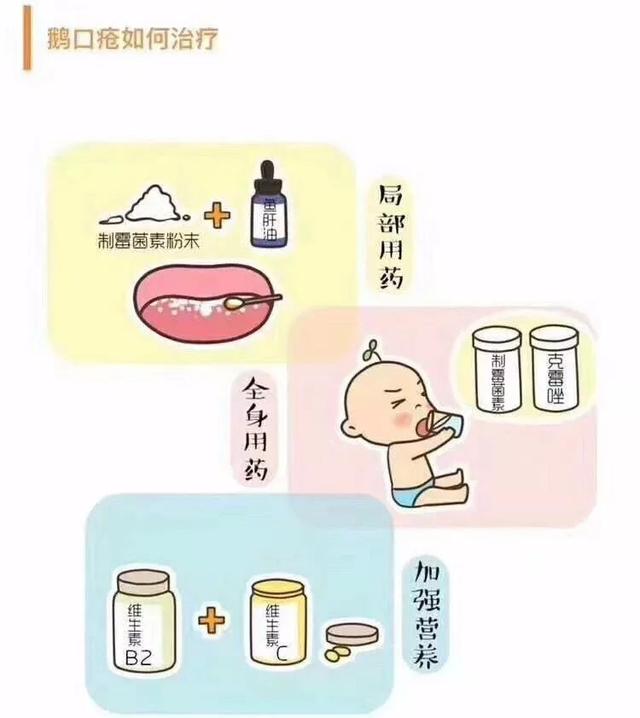 鹅口疮是什么，鹅口疮反反复复怎么办（一图看懂鹅口疮）