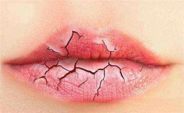 把蜂蜜涂在b上，嘴角起泡可以弄破吗（却不知道是缺少它）