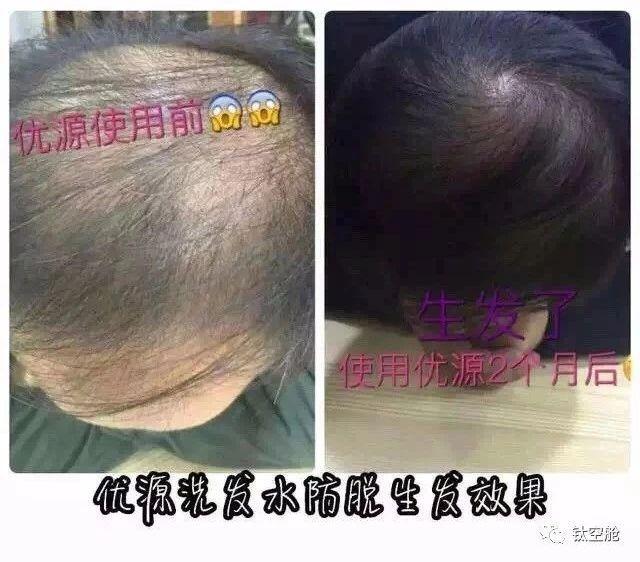 如何运用本草纲目养发护发，本草纲目治疗生发偏方（专为脱发人群设计的洗发露）