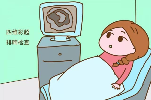 做四维彩超注意事项，做四维彩超的注意事项（圣德科普：四维彩超的注意事项）