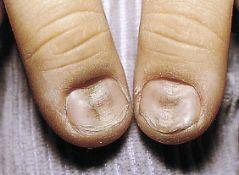 手指甲是什么组成的，手指甲是什么组成的图（宝贝指甲长得不好）