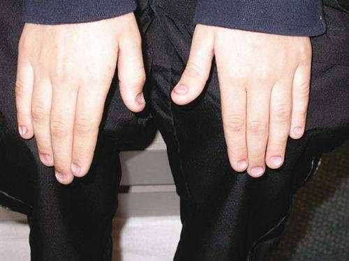 手指甲是什么组成的，手指甲是什么组成的图（宝贝指甲长得不好）