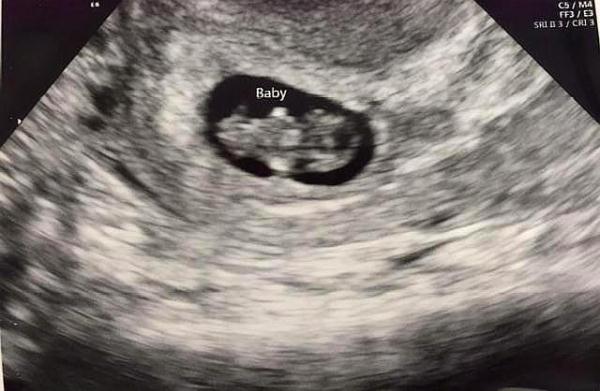 怀孕正常hcg值是多少，怀孕hcg正常值是多少（怀孕后的第一次产检）