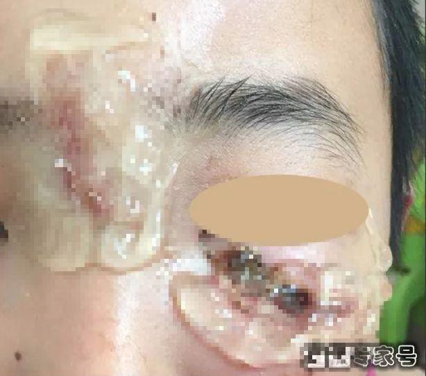 芦荟胶的作用和功效，无知毁了多少女人和孩子