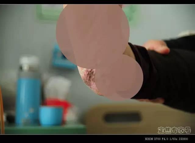 四季不安痣是什么意思，女人面部痣相图解（身体这些部位长\