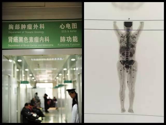 四季不安痣是什么意思，女人面部痣相图解（身体这些部位长\