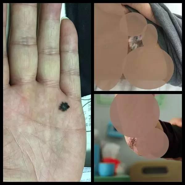 四季不安痣是什么意思，女人面部痣相图解（身体这些部位长\