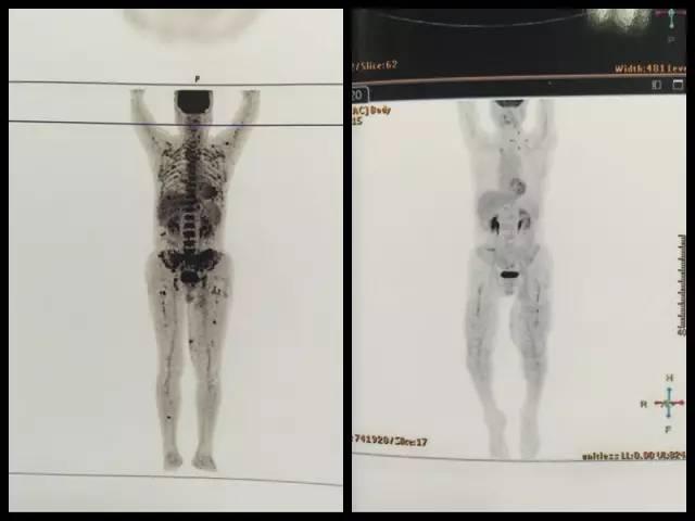 四季不安痣是什么意思，女人面部痣相图解（身体这些部位长\