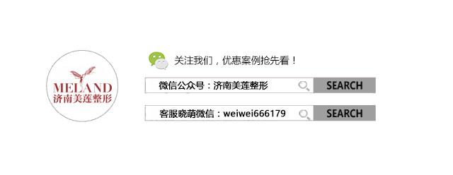 做双眼皮好吗，女生来例假前做双眼皮好吗（妹子仅仅做了双眼皮）