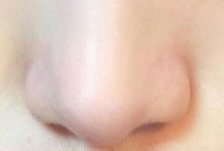 去黑头收缩毛孔，去黑头收缩毛孔最有效的方法是什么（去黑头收缩毛孔最好的产品有哪些）