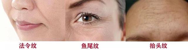 胶原蛋白对眼部皱纹有效吗，口服胶原蛋白能改善眼部皱纹吗（细纹、松垂、色斑都搞定）