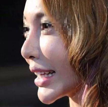 胶原蛋白对眼部皱纹有效吗，口服胶原蛋白能改善眼部皱纹吗（细纹、松垂、色斑都搞定）