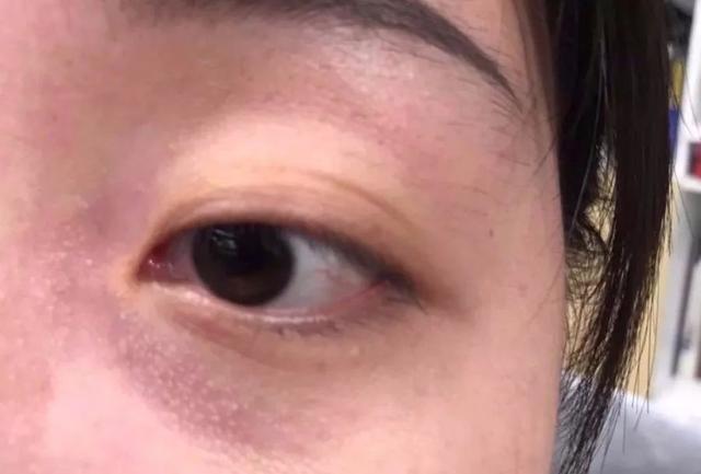 胶原蛋白对眼部皱纹有效吗，口服胶原蛋白能改善眼部皱纹吗（细纹、松垂、色斑都搞定）