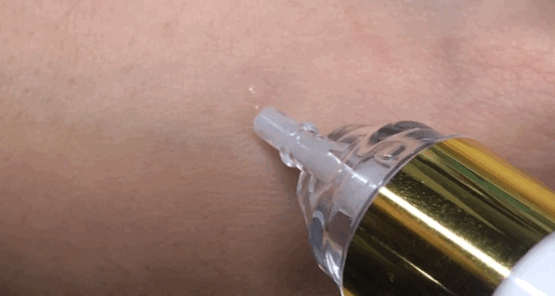 胶原蛋白对眼部皱纹有效吗，口服胶原蛋白能改善眼部皱纹吗（细纹、松垂、色斑都搞定）