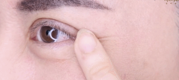 胶原蛋白对眼部皱纹有效吗，口服胶原蛋白能改善眼部皱纹吗（细纹、松垂、色斑都搞定）