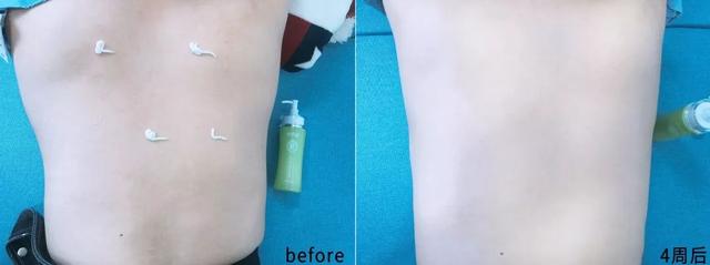 背薄一寸下一句是什么，背薄一寸下一句话怎么说（千万别做“背厚”的人）