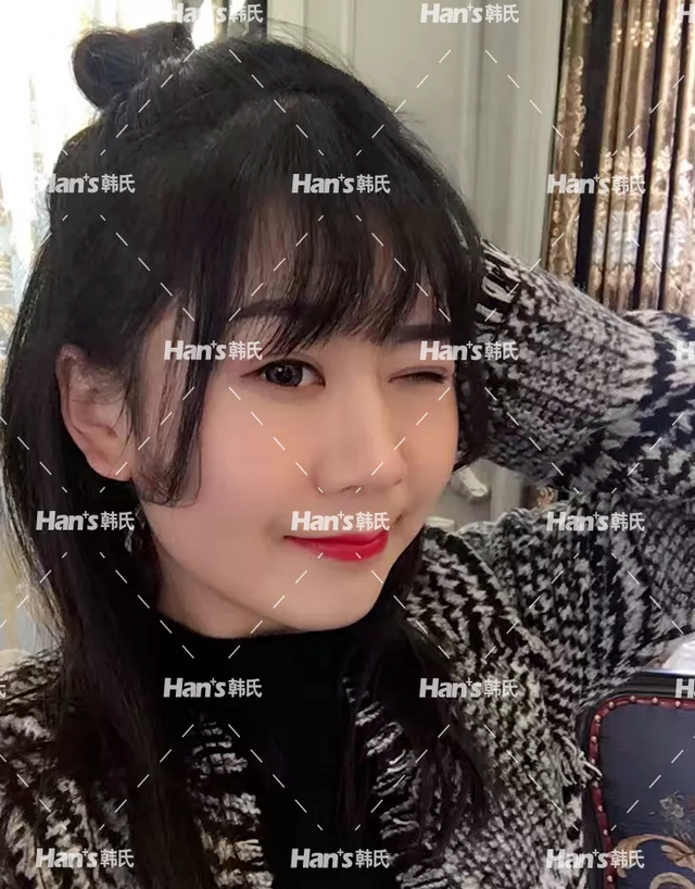 眼皮抽脂效果好吗，眼皮抽脂的好处（到底该去吸脂还是做双眼皮）