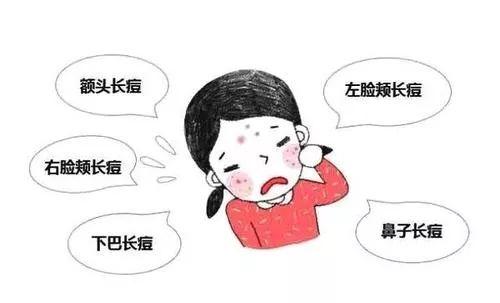 闭口和痘痘的区别，长痘痘和闭口的区别（其实并不相同....）