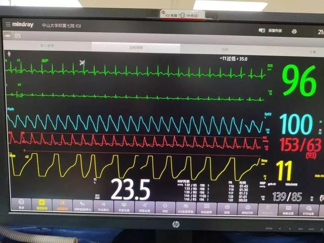  监护仪上的pr过高什么意思，ICU的床旁监护，你会看吗