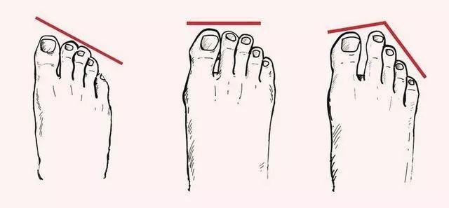 勒脚，女人的真/假精致，看她的脚（勒脚怎么读）