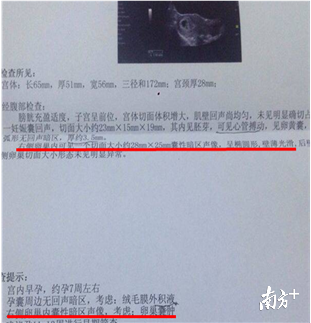 女性囊肿是什么原因引起的，女性卵巢囊肿是什么原因引起的（B超单的“囊肿”要这样解读）