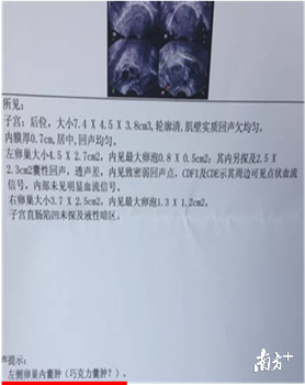 女性囊肿是什么原因引起的，女性卵巢囊肿是什么原因引起的（B超单的“囊肿”要这样解读）